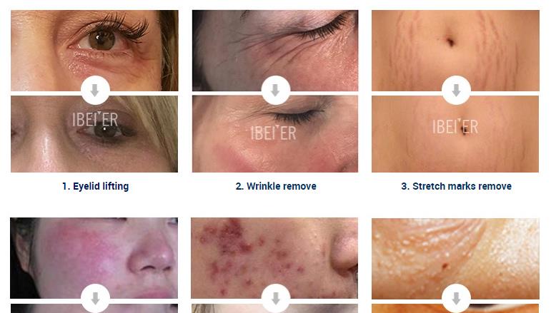 product-1-1 4 Plexr.jpg