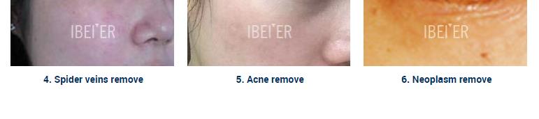product-1-1 5 Spot Removal Pen