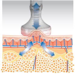 a2tc_Vacuum-Suction