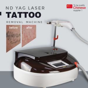 Nd Yag Laser For Pigmentation